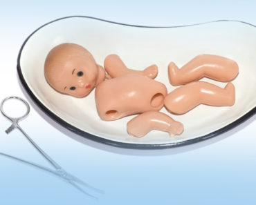 Aborto espontáneo: qué es y por qué sucede