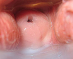 Posicion del cuello uterino y como cambia al ovular