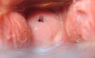 Posicion del cuello uterino y como cambia al ovular